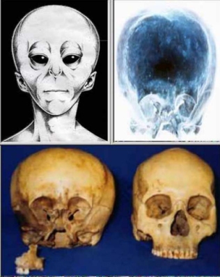 Resultados del análisis 2010 al ADN del cráneo Starchild.  B0111-starchild-skull-pictures